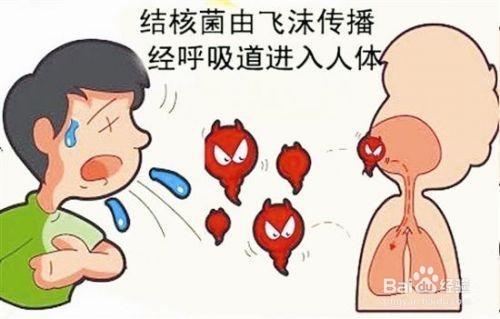 如何预防肺结核？